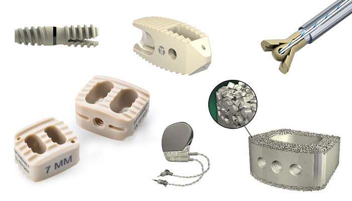 8 основных преимуществ PEEK в медицинских применениях 8 основных преимуществ PEEK в медицинских применениях